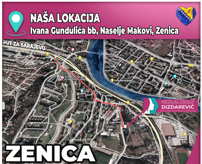 lokacija-Medical-Group-Dizdarevic